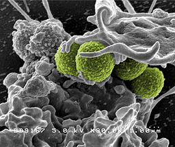 256px-Hospital-associated_Methicillin-resistant_Staphylococcus_aureus_MRSA_Bacteria