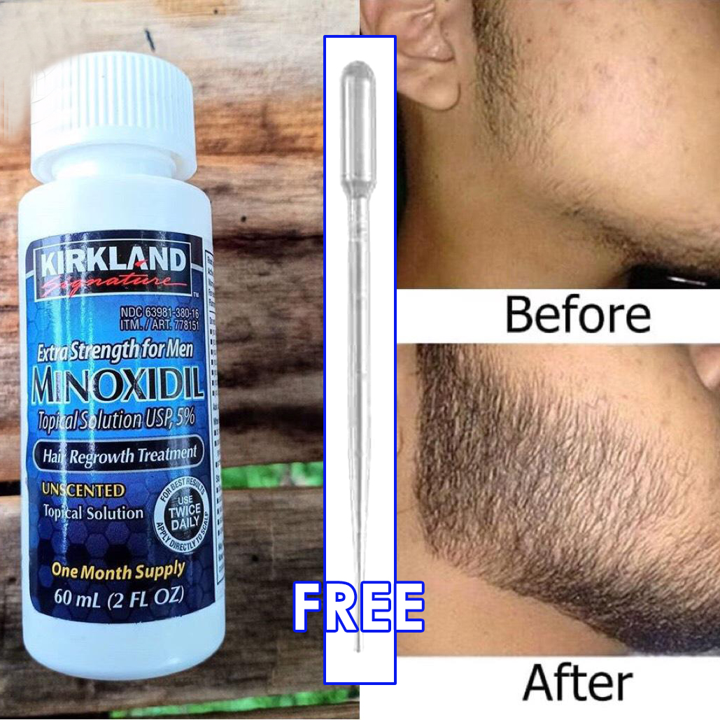 Minoxidil  real reviews consumer reports - products - amazon - walmart